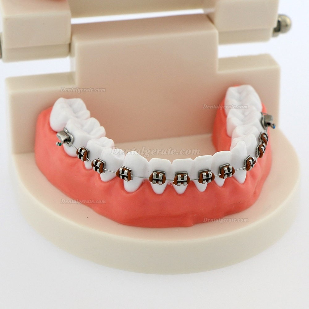 Dental Teach Typodont Demonstrationszahnmodell mit Zahnspangen F&uuml;r die Patientenstudie 5006